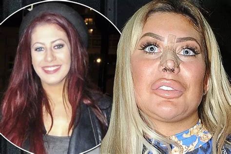 chloe ferry surgery